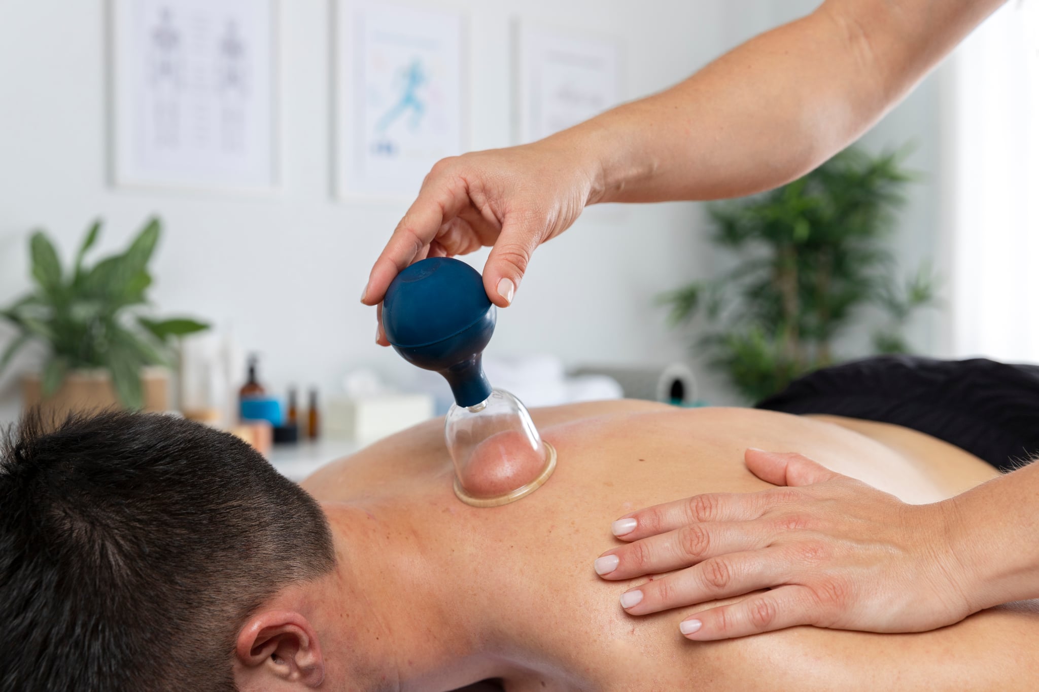 Cupping Therapy for Pain Relief: What You Need to Know 